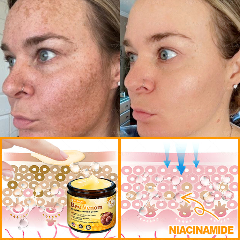 Made and Shipped from USA ✨ VLSVLS® Bee Venom Skin Restoration Cream 🔥 LAST DAY 80% OFF 🔅🔅🔅