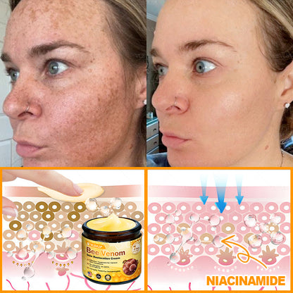 Made and Shipped from USA ✨ VLSVLS® Bee Venom Skin Restoration Cream 🔥 LAST DAY 80% OFF 🔅🔅🔅