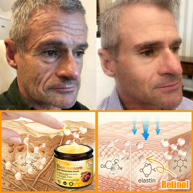 Made and Shipped from USA ✨ VLSVLS® Bee Venom Skin Restoration Cream 🔥 LAST DAY 80% OFF 🔅🔅🔅