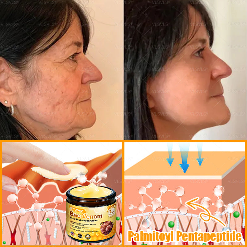 Made and Shipped from USA ✨ VLSVLS® Bee Venom Skin Restoration Cream 🔥 LAST DAY 80% OFF 🔅🔅🔅