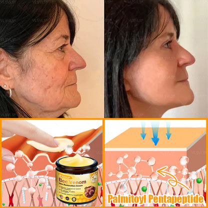 Made and Shipped from USA ✨ VLSVLS® Bee Venom Skin Restoration Cream 🔥 LAST DAY 80% OFF 🔅🔅🔅