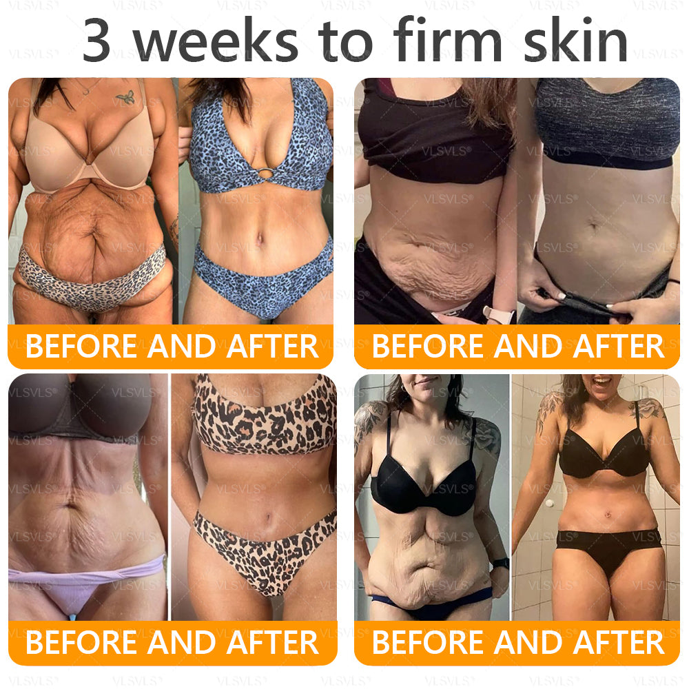 Made and Shipped from USA ✨ VLSVLS® Bee Venom Skin Restoration Cream with Collagen & Matrixyl 3000 | Obesity🔥 Sagging Skin, Fine Lines, Loss of Firmness, Flat Bust, Drooping Hips, and More🔥 LAST DAY 80% OFF 💎💎💎