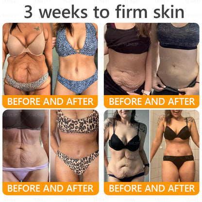 Made and Shipped from USA ✨ VLSVLS® Bee Venom Skin Restoration Cream with Collagen & Matrixyl 3000 | Obesity🔥 Sagging Skin, Fine Lines, Loss of Firmness, Flat Bust, Drooping Hips, and More🔥 LAST DAY 80% OFF 💎💎💎