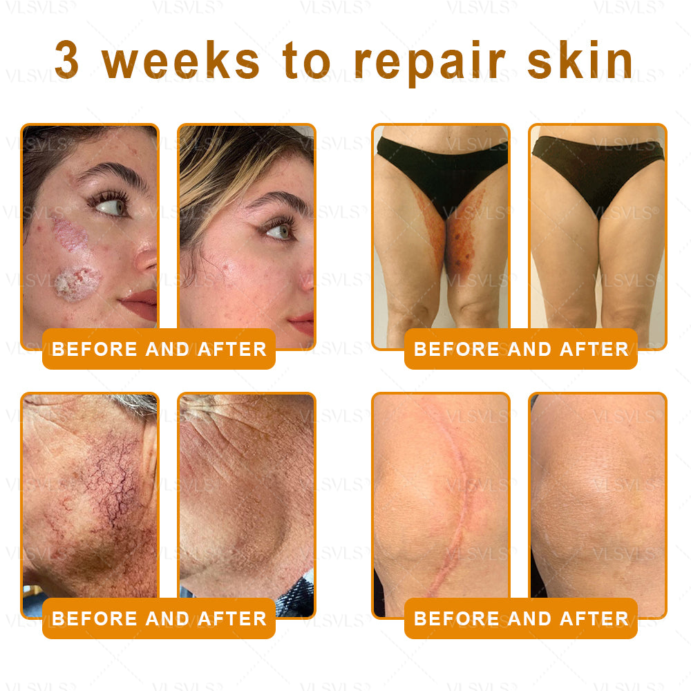 Made and Shipped from USA ✨ VLSVLS® Bee Venom Skin Restoration Cream 🔥 LAST DAY 80% OFF 🔅🔅🔅
