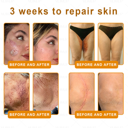 Made and Shipped from USA ✨ VLSVLS® Bee Venom Skin Restoration Cream 🔥 LAST DAY 80% OFF 🔅🔅🔅